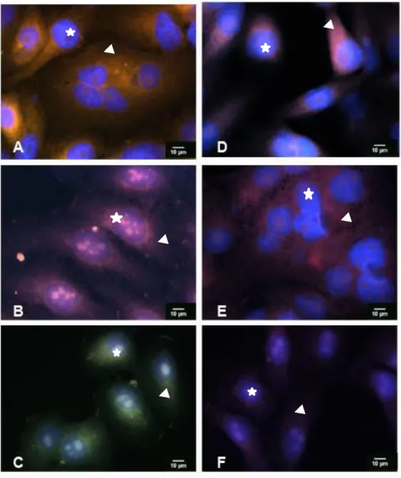 Figura 5 - Células HEp-2 incubadas com anticorpos anti-HSPs. Células HEp-2  incubadas com anticorpo anti-HSP-27 e anticorpo anti-HSP70, e marcadas com DAPI