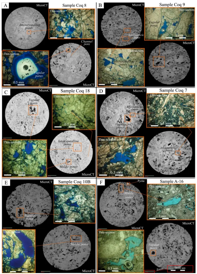Figure 4 – Pore types observed in thin sections and µ -CT images, following the Choquette &amp; Pray (1970) nomenclature: (A) Coq 8 (facies T2); (B) Coq 9, facies T2; (C) Coq 18, facies T4; (D) Coq 7, facies T5; (E) Coq 10B, facies T5; and (F) A-16, facies