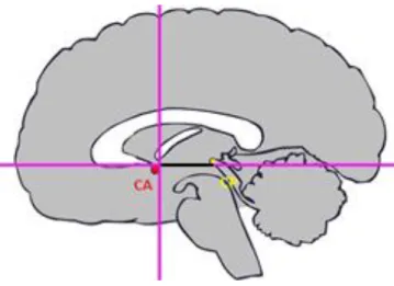 Figura 2.10. Figura esquemática da localização da CA e CP. Adaptado de (Rorden, 2002)