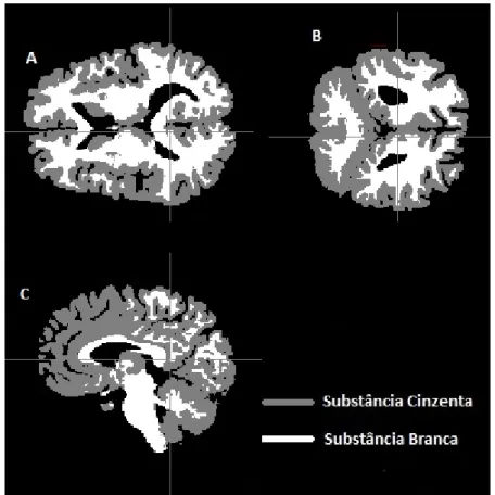 Figura 3.14. Resultados da segmentação obtidos pelo FAST com sobreposição das substâncias branca  e cinzenta nos planos coronal (A), sagital (B) e transversal (C) obtidos a partir do FSLview 