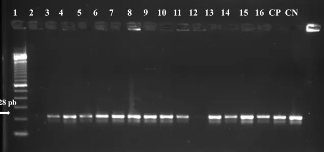 Figure 1 - Agarose gel electrophoresis to search for the 16S rRNA gene (228 bp) through PCR technique