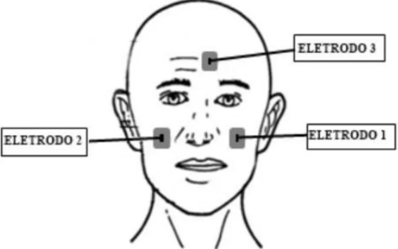 Figura 2. Disposição dos eletrodos na face. 