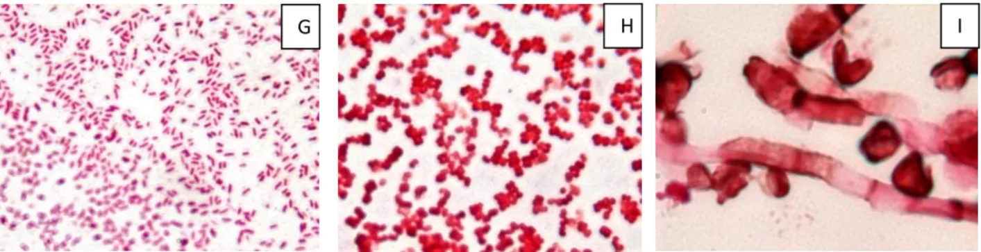Fig. 9. (G) Micromorfologia de colônia bacteriana: Bacilos. Coloração Gram-positiva, 1600x