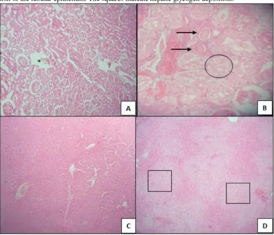 Figure 4. Kidney and hepatic histopathological evaluation. (A, B) Histopathological analyses of the kidneys in  rats  that  received  (A)  vehicle  (Basal  group,  n  =  8)  and  (B)  streptozotocin  (Diabetic  group,  n  =  8)