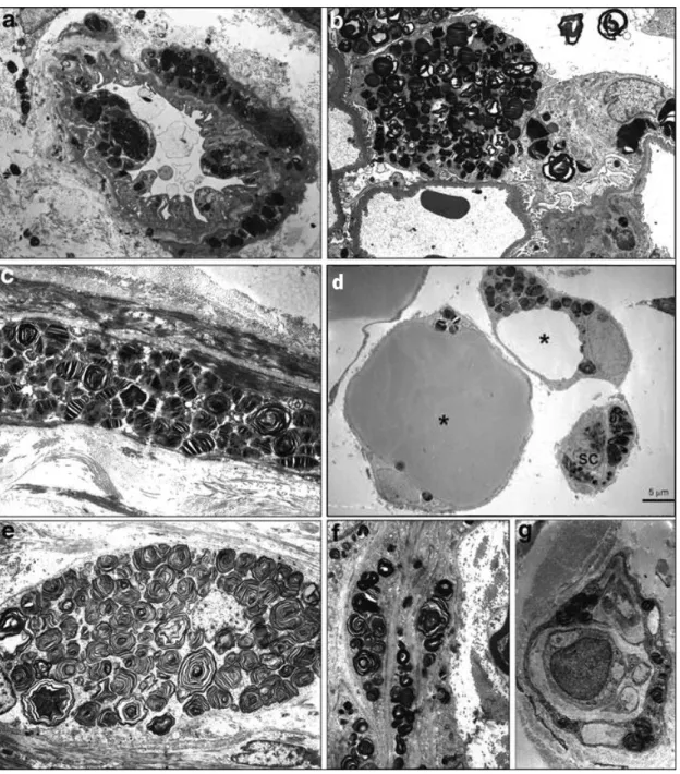 Figure  5:  Some  cell  types  known  to  express  high  degree  of  storage  in  Fabry  disease