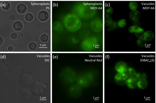 Figure  2  -  Microscopy  analysis  of  spheroplasts  and  vacuoles  isolated  from  yeast