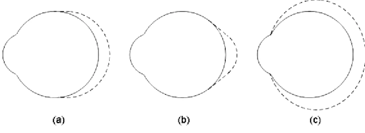 Figura  1-2  Modelos  de  crescimento  do  olho  míope:  a)  alongamento  equatorial;  b)  alongamento  somente  do  polo  posterior;  c)  e expansão  total