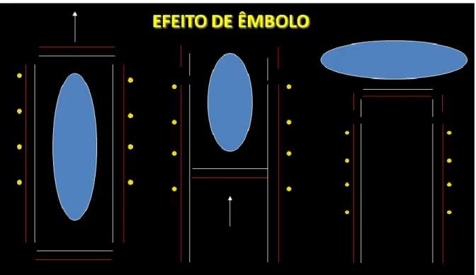 Figura 10 – Efeito de Êmbolo 