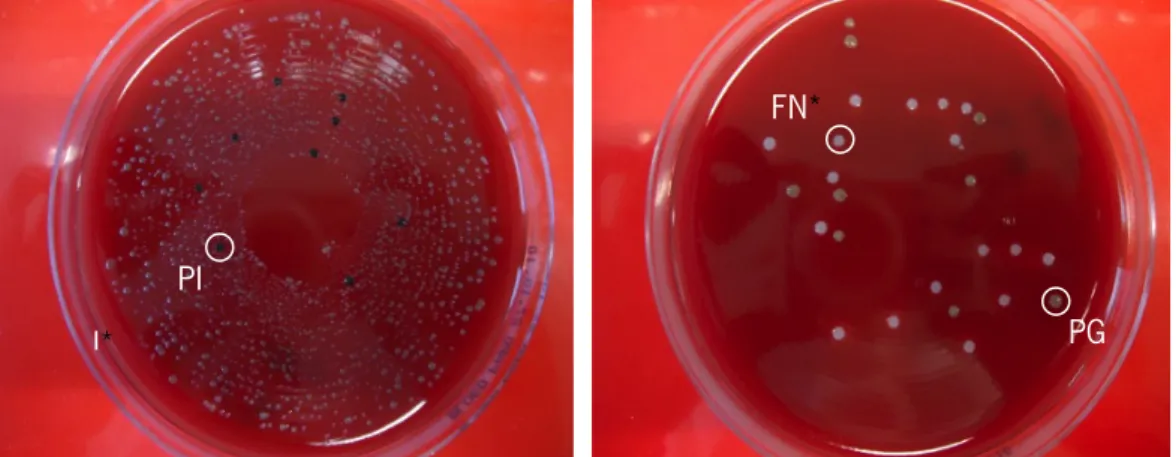 Figure 7. Blood agar plates supplemented with horse blood used to determine CFU of the 3 bacteria (PI - black, PG -  green and FN - white)