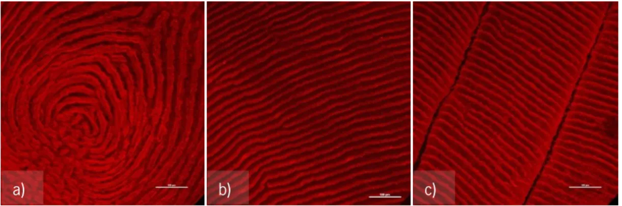 Figure 3.2 - Fish scale observed in the Confocal Microscope with Direct Red 80 staining for collagen  identification: a) center, b) side and c) top areas of the scale 