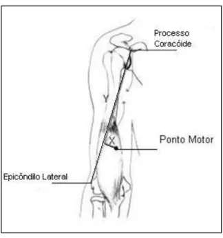 Figura 13  Esquema ilustrativo da identificação anatómica do ponto moto do músculo Braquail