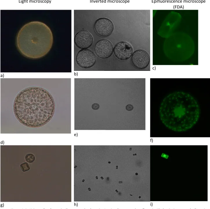 Figure 2.6. Living cells of  centric diatoms. a,  b, c) strain  Coscinodiscus sp.; d, e, f) strain Thalassiosira sp.; g, h, i) strain  Cyclotella meneghiniana
