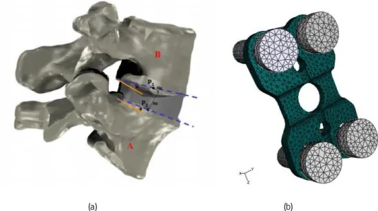 Figure 1.7 – Hybrid model developed by Monteiro: (a) co-simulation model; and (b)  fixation plate model with titanium  fixation screws {Adapted  from (Monteiro, 2009)}