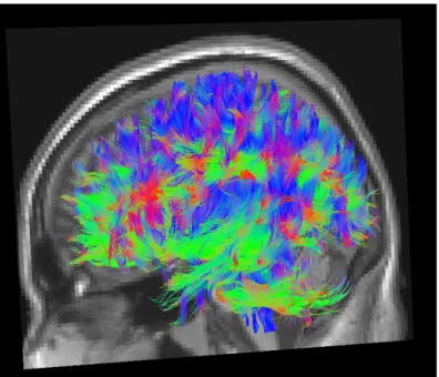 Figura 1.2. Principais feixes de fibras neuronais presentes no cérebro humano obtidos por  tratografia via DTI