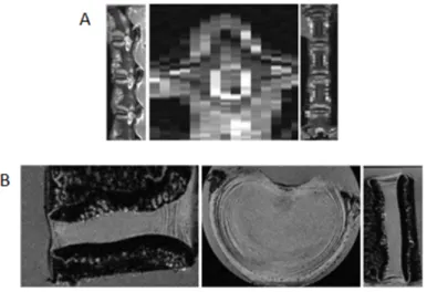 Figure 4.2 – The three main imaging plans of the  human body: sagittal (YZ), coronal (XZ)  