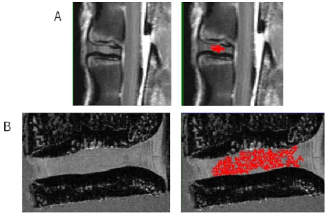 Figure 4.7 – The region growing algorithm applied to the (A) MR and (B) micro-MR images