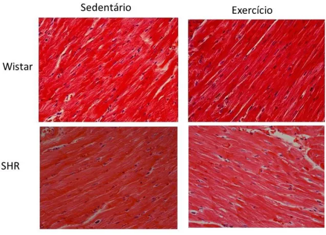 Figura  2:  Fotomicrografias  representativas  do  ventrículo  esquerdo  de  ratos  normotensos  e  hipertensos