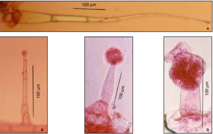 Figura 1 - Tricomas glandulares em folíolos de  duas espécies de tomateiro,  Lycopersicon esculentum Mill