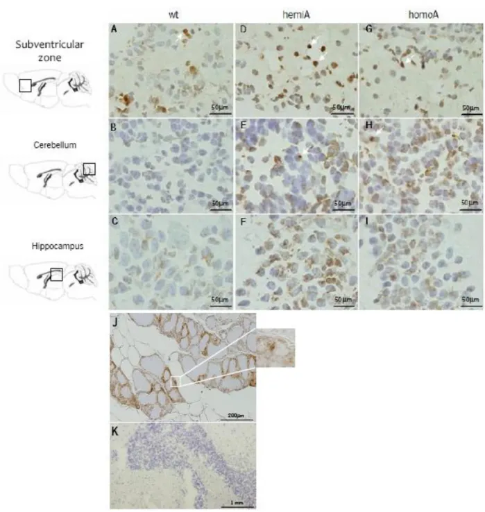 Figure 4.1. TUNEL assay of non-transgenic, hemi and homozygous MJD transgenic mice at 86-100  weeks of age in subventricular zone, cerebellum and hippocampus