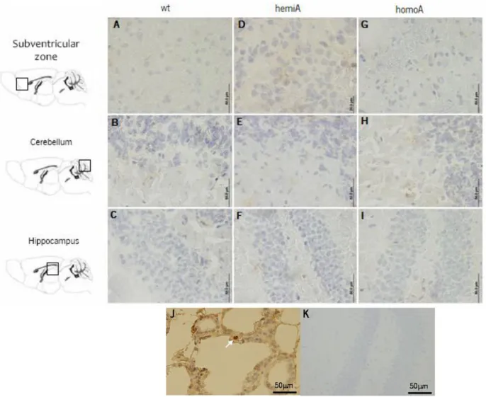 Figure 4.2. IHC anti-active caspase-3 of non-transgenic, hemi and homozygous MJD transgenic mice at 86-100 weeks  of age in subventricular zone, cerebellum and hippocampus