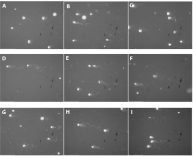 Figure 10 – Photomicrographs of yeast comets after DNA staining with GelRed.  A: control experience only  with S buffer;  B: cells treated with 10 mM H 2 O 2 ; C: incubation with ethanol; D: incubation with 300 µg/mL PEE; E: 