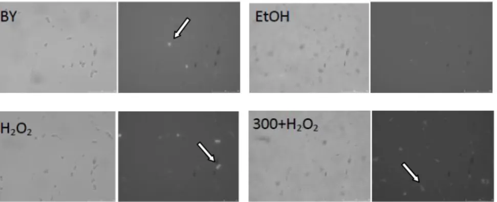 Figure 12 – Photomicrographs of S. cerevisiae cells with fluorescence (H 2 DCFDA) after co-incubation with S  buffer (BY; 200x magnification), ethanol (EtOH; 400x magnification), H 2 O 2  10 mM (H 2 O 2 ; 200x magnification), and  PEE and H 2 O 2  (300+H 2