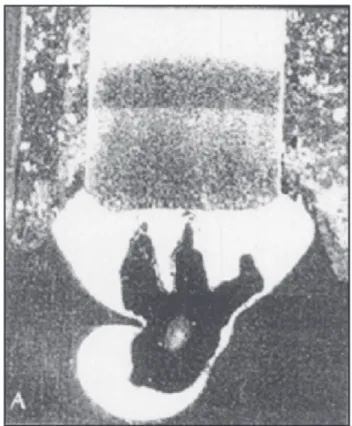 Figura 4. Radiografia de solda feita a 100 metros em aço A-36  com o Eletrodo E6013 [3].