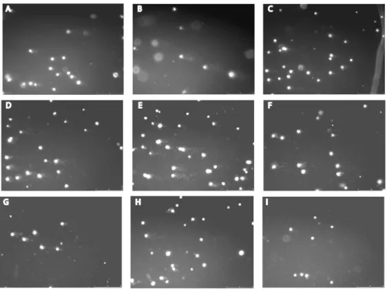 Figure  4  –  Images  of  the  yeast  comet  assay  after  DNA  labelling  with  ethidium  bromide