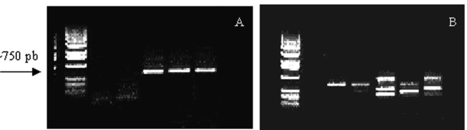 Figura 1. Eletroforese em gel de agarose a 1% corado com brometo de etídio de fragmentos do genoma do Banana streak virus (BSV) amplificados com “primers” degenerados, a partir de amostras foliares de bananeira: A