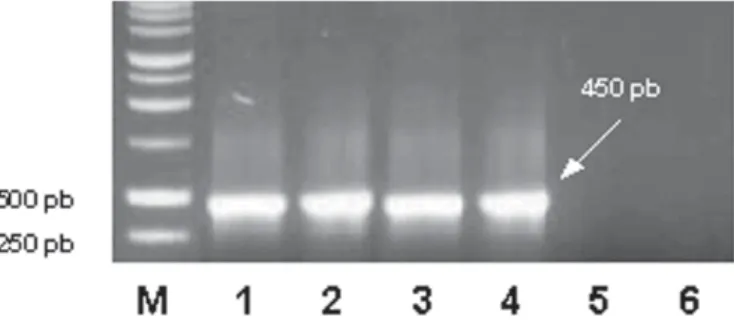 Figura 2. Fragmentos amplificados por RT-PCR, observados em gel de agarose 1%, corado com brometo de etídeo