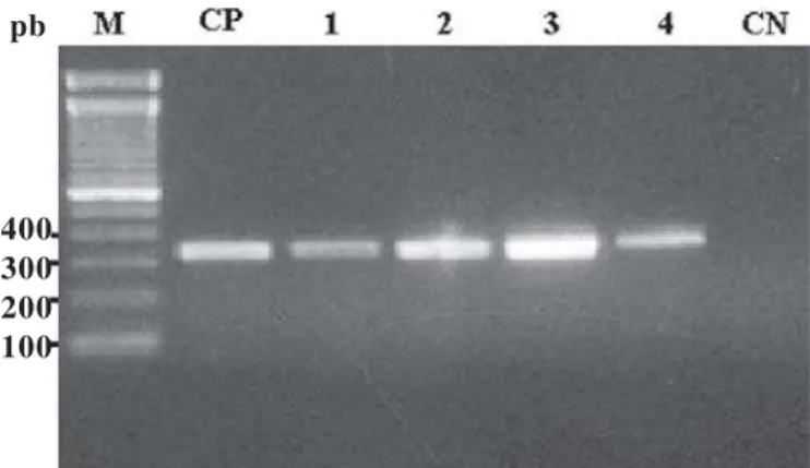 Figura 1. Produtos da reação da polimerase em cadeia (PCR) com os oligonucleotídeos UBC85F 410  e UBC85R 410 , os quais são específicos para Fusarium graminearum; onde: M, marcador; CP, controle positivo (isolado NRRL2903 de F