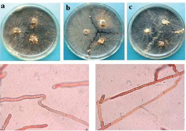 Figura 2. Interações somáticas macroscópicas e microscópicas entre isolados de Rhizoctonia solani AG-1 IA da soja: a) interação somaticamente compatível (nenhuma demarcação distinta na zona de interação das hifas entre isolados pareados); b) interação soma