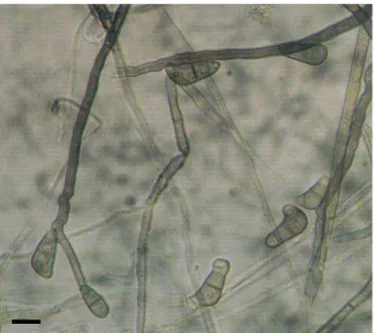 Figura 2. Conídios e conidióforos produzidos “in vitro” por Curvularia lunata isolado da jurubeba