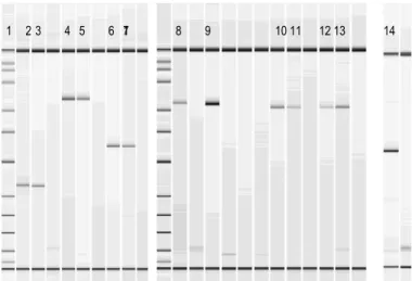 Figura 7 – Análise de electroforese para verificação de amplificação dos produtos de PCR para sequenciação do gene PIGA
