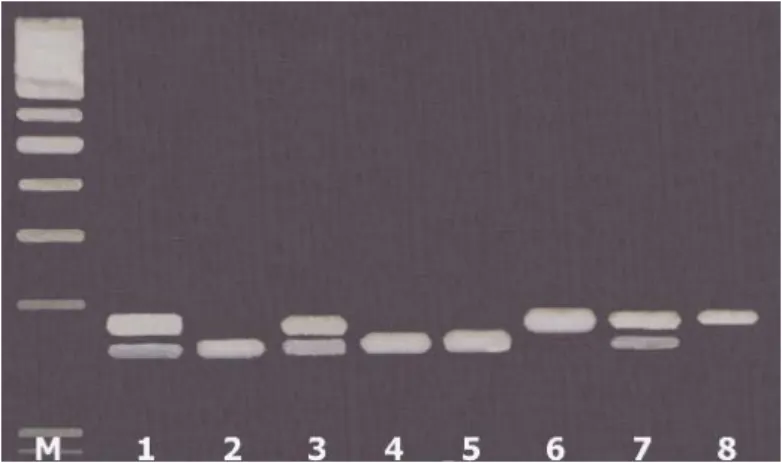 Figura 10 – Análise do polimorfismo A870G no gene CCND1 por RFLP em gel de  agarose a 3%, exemplificando os três padrões de RFLP obtidos