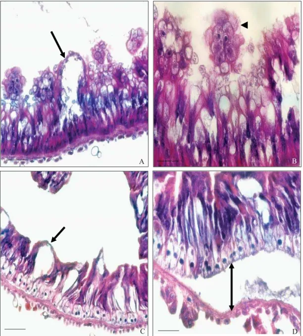 Fig 4 Mesêntero de lagartas de Spodoptera frugiperda alimentadas com folhas de milho tratadas com nim: (A) Projeção do  tecido epitelial em lagarta na concentração 0,5%, intervalo de tempo de 144h