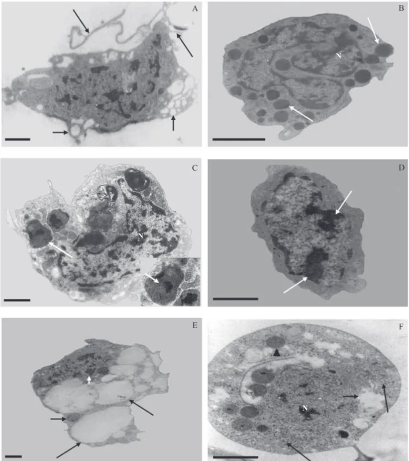 Fig 1 Hemócitos de Nasutitermes coxipoensis. A - Plasmatócito - célula com prologamentos citoplasmáticos (setas longas)  e numerosas vesículas (setas curtas)