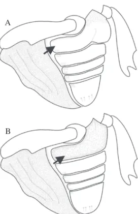 Fig. 4. Vista ventral do abdome de fêmea (A) e macho (B)  de  C.  psidii  mostrando a convexidade do primeiro esternito  abdominal da fêmea e a diferente distribuição de pilosidade  em relação ao macho.