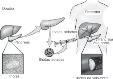 Figura  1.  Esquema  geral  do  procedimento  (Adaptado  de  U.  de  Minnesota).