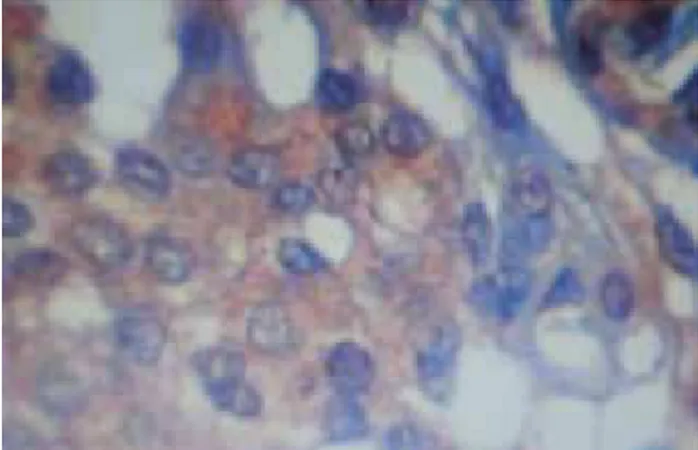 Figura 4. Imuno-histoquímica do testículo direito mostrando a expressão de PS100  (proteína neural).