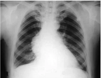 Figura 1.  Radiograia do tórax.