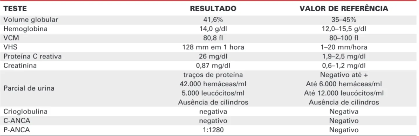 Tabela 1. Exames laboratoriais durante o início das manifestações cutâneas induzidas pelo PTU.