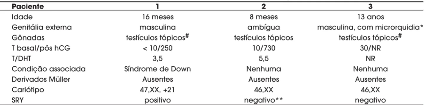Tabela 2. Pesquisa de marcadores moleculares do cro- cro-mossomo Y em três pacientes com diagnóstico de homem XX.