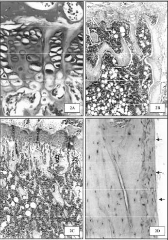 Figura 2. Ossos de ratas eutireóideas castradas. A) Tíbia proximal com placa epifisária pouco diferenciada e com colunas de condrócitos irregulares