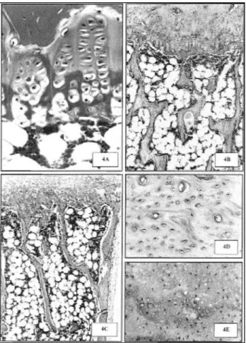 Figura 4. Ossos de ratas hipotireóideas castradas. A) Tíbia proximal com placa epifisária pouco diferenciada e zona hipertrófica com células de tamanho reduzido e com  pic-nose nuclear