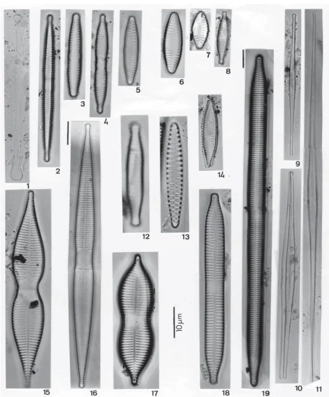 Figura 1. Asterionella formosa  var. formosa. Figuras 2-4. Fragilaria capucina var. fragilarioides