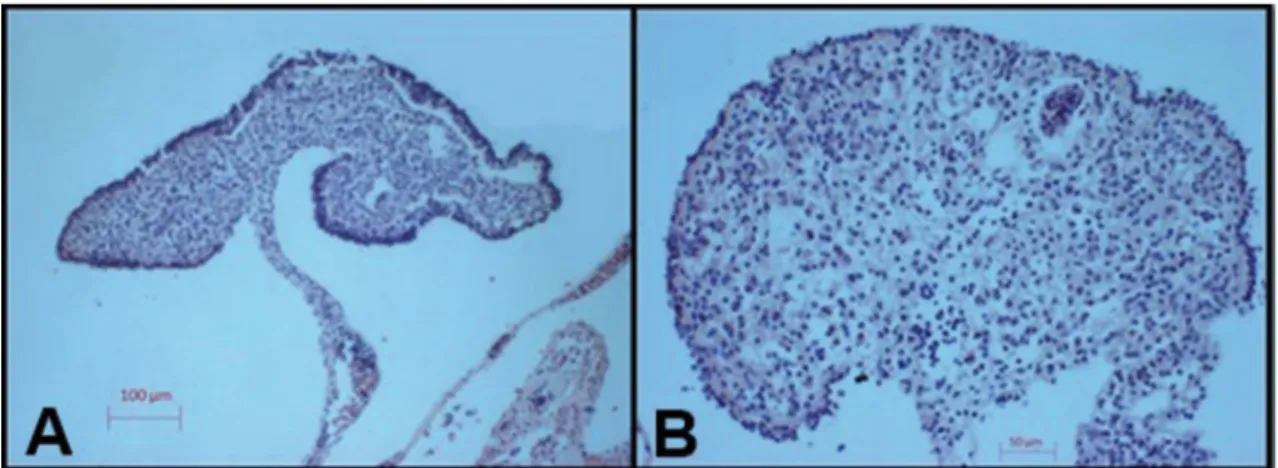 FIgURA 3: Gônadas de neonatos fêmea de E. imbricata evidenciando um córtex bem desenvolvido (A) e uma porção medular pouco  organizada (B).