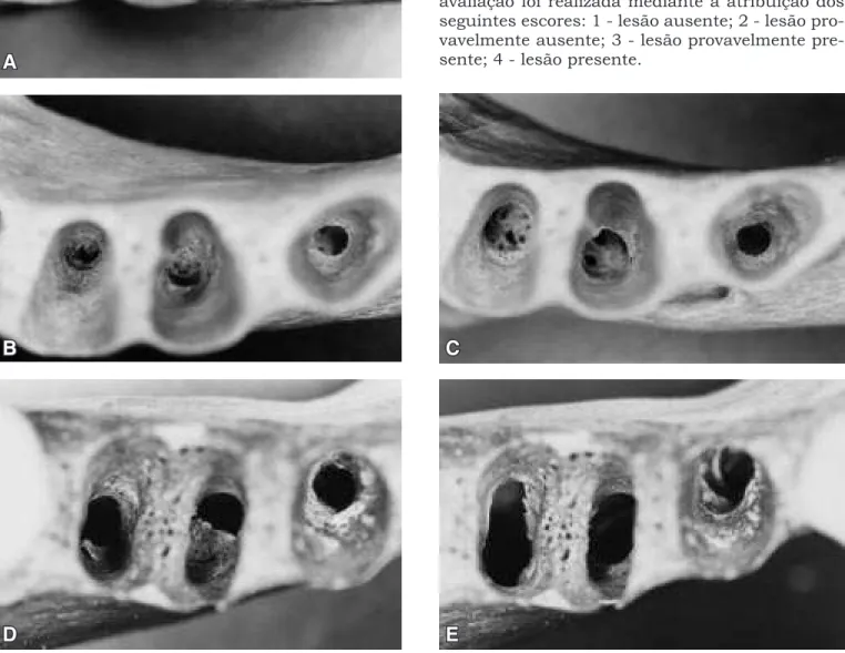FIGURA 1 - Lesões ósseas produzidas artificialmente: inicial (A); broca 6 (B); broca 8 (C); broca 10 (D); cortical (E).