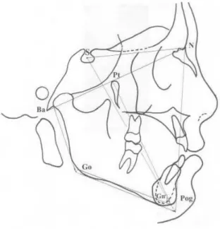 FIGURA 1. Traçado cefalométrico das estruturas anatômicas, com os pontos, as linhas e os planos cefalométricos.