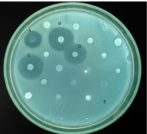 Figure 1.  Heteroantagonistic activity Bacteroides fragilis samples of patients with intra-abdominal infection